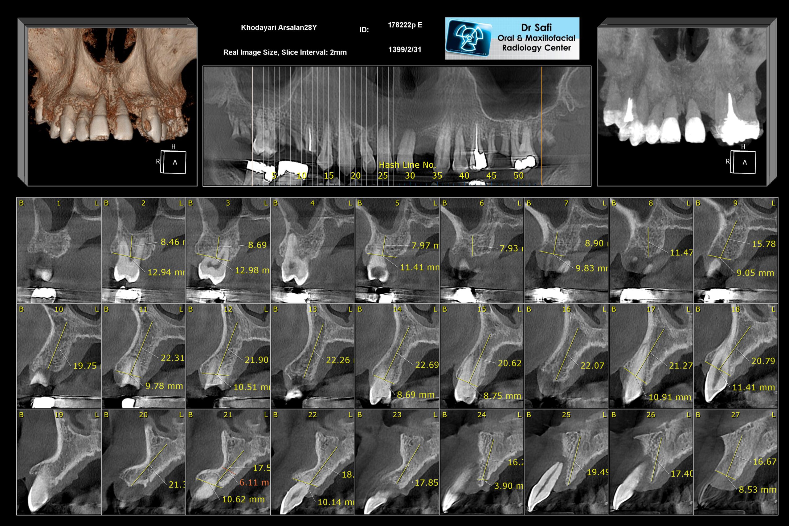 Cone Beam Computed Tomography Cbct Specialized Radiology Services
