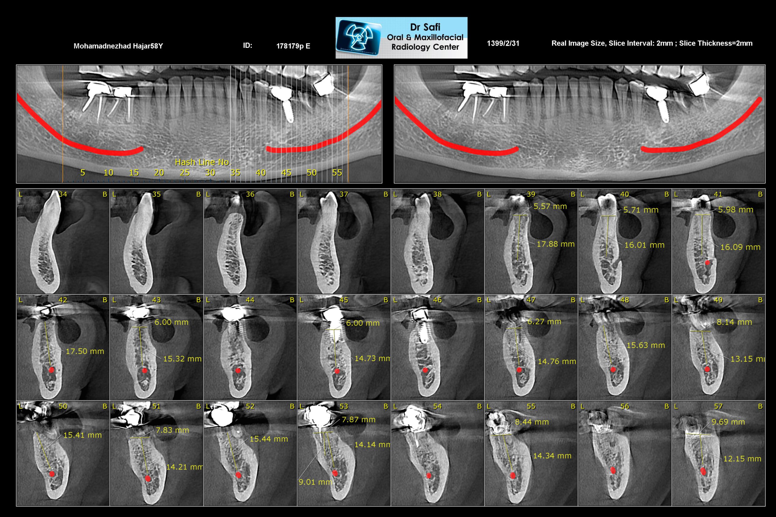 Cone Beam Computed Tomography Cbct Specialized Radiology Services