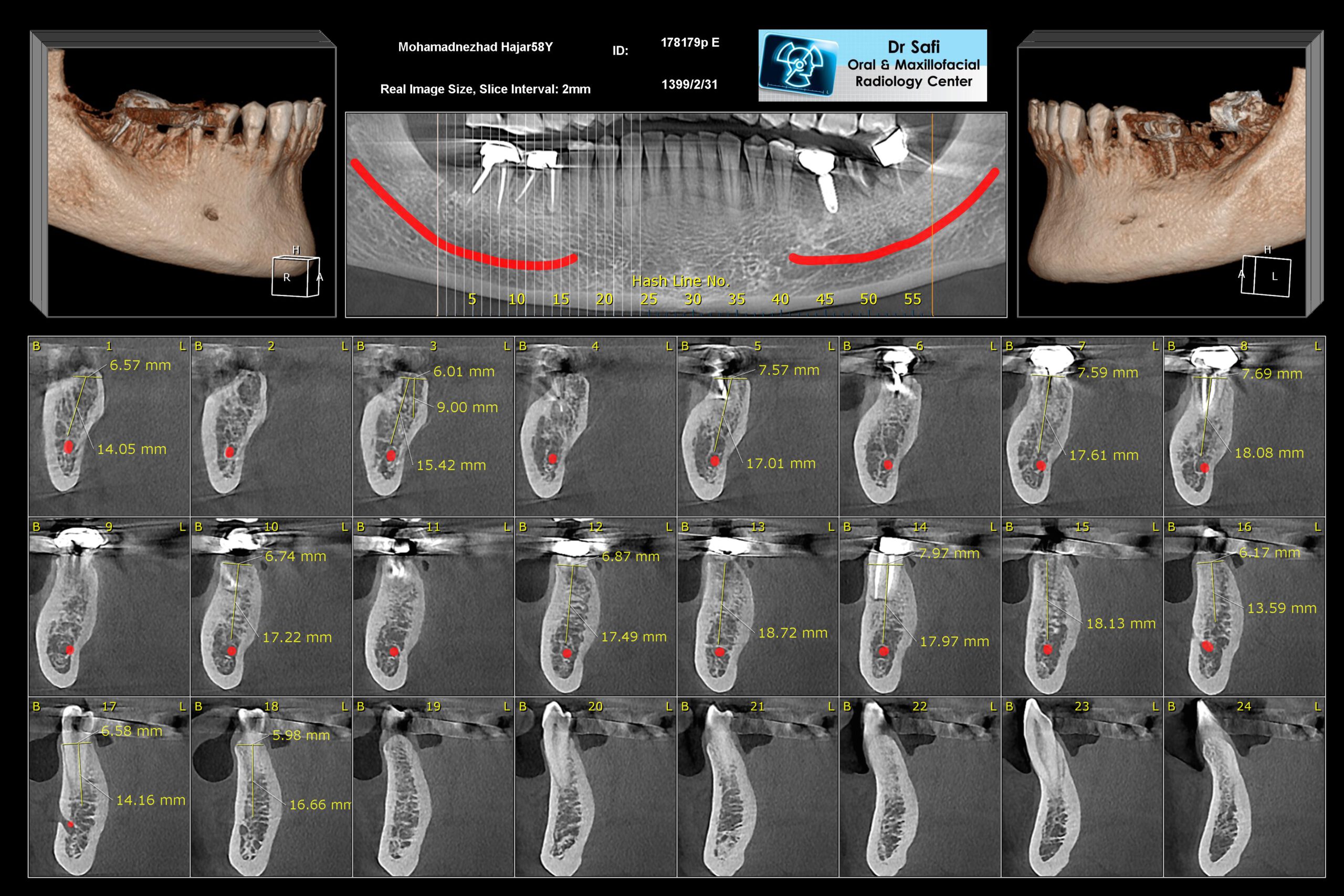 Cone Beam Computed Tomography Cbct Specialized Radiology Services