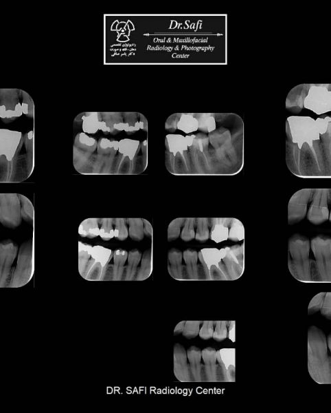 a5be62d4-e4fa-4ce8-ade2-75122b893667 a5be62d4-e4fa-4ce8-ade2-75122b893667
