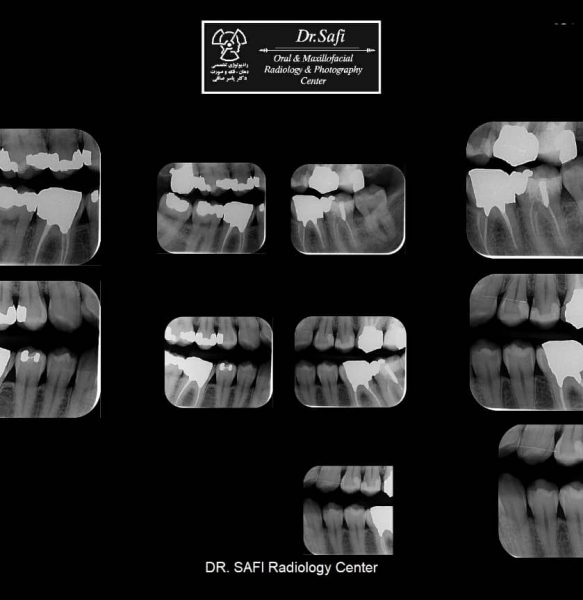 a5be62d4-e4fa-4ce8-ade2-75122b893667 a5be62d4-e4fa-4ce8-ade2-75122b893667
