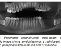 Oral Hard Tissue Lesions: A Radiographic Diagnostic Decision Tree
