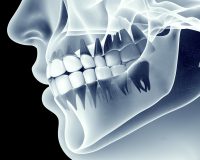 دوز اشعه در رادیوگرافی دهان و دندان: از تصور تا واقعیت!!!