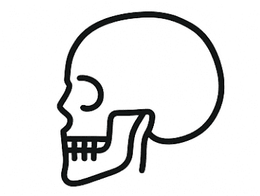 سفالومتری (Lateral cephalometric)